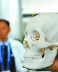 国内首个3D打印颅骨引来围观
