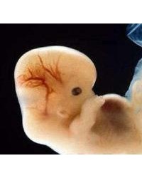 美国家科学院报告支持基因编辑人类胚胎